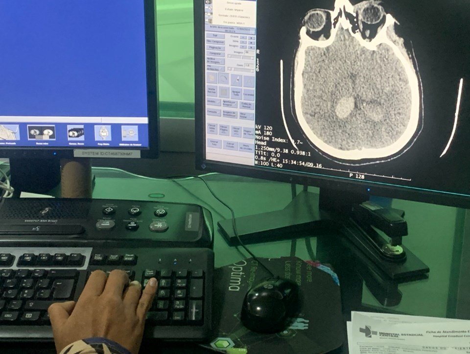 Calor e AVC: neurologista explica os riscos e como se prevenir